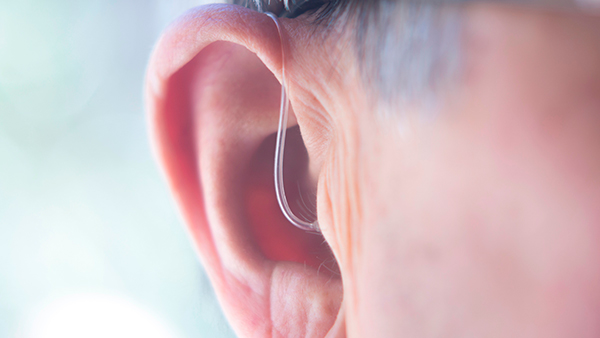 Kuulolaakso vauhdittaa kuulonhuollon innovaatioita potilaiden hyväksi