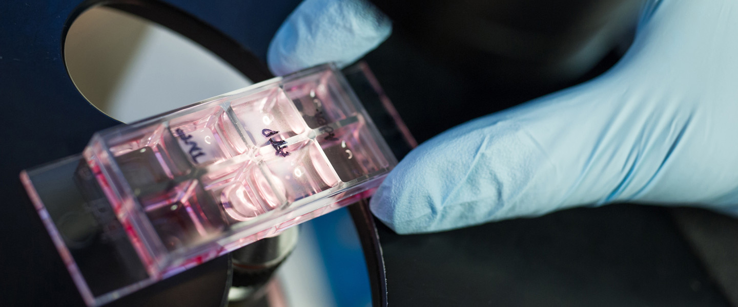 SYLI – Living Biobank – Cancer Laboratory Project Kick-off